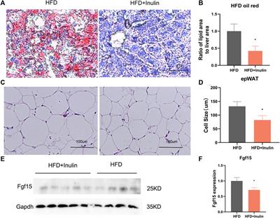Inulin ameliorates metabolic syndrome in high-fat diet-fed mice by regulating gut microbiota and bile acid excretion